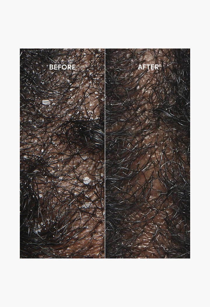 Ouai Anti-Dandruff Hair Shampoo