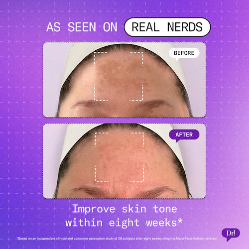Major Fade Hyper Serum Dark Spot + Hyperpigmentation Treatment with Niacinamide and Glycerin - GLAM MODA