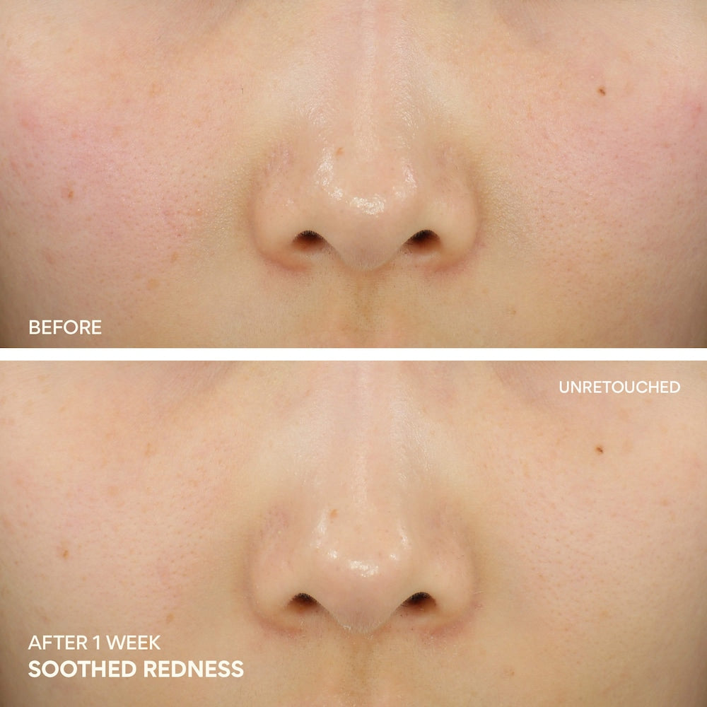Green Tea Ceramide Cream for Redness & Barrier Repair - GLAM MODA