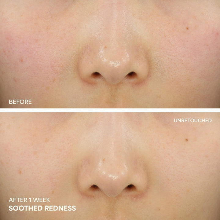 Green Tea Ceramide Cream for Redness & Barrier Repair - GLAM MODA