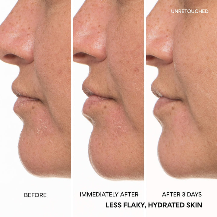 Green Tea Ceramide Milk Toner for Hydration & Barrier Repair - GLAM MODA
