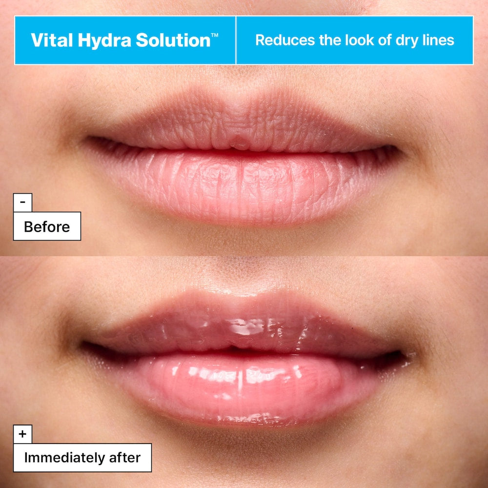 Vital Hydra Solution™ Jelly Bear Lip Mask with Hyaluronic Acid - GLAM MODA