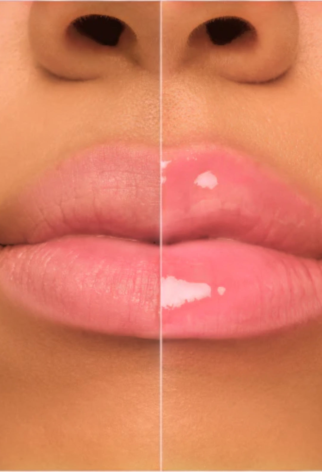 Filler Supreme Lip Gloss