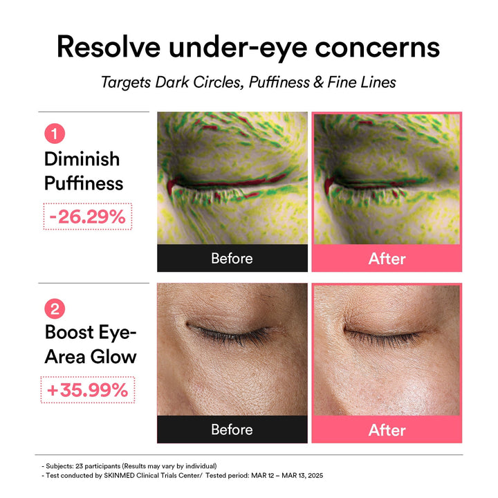 PDRN Retinal Eye Patch Glow Jelly - GLAM MODA