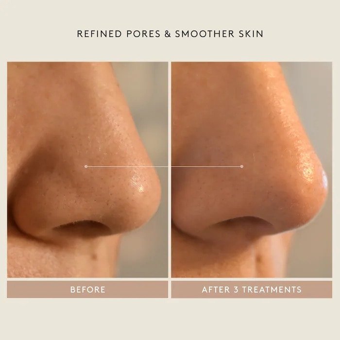 Mini Triple Acid Signature Peel - GLAM MODA