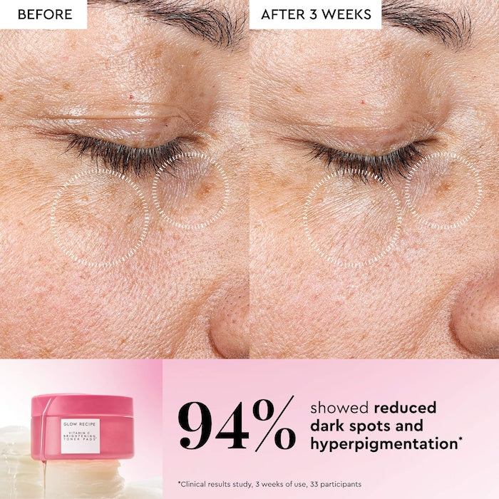 Vitamin C Brightening Korean Guava Toner Pads for Undereye & Cheeks - GLAM MODA