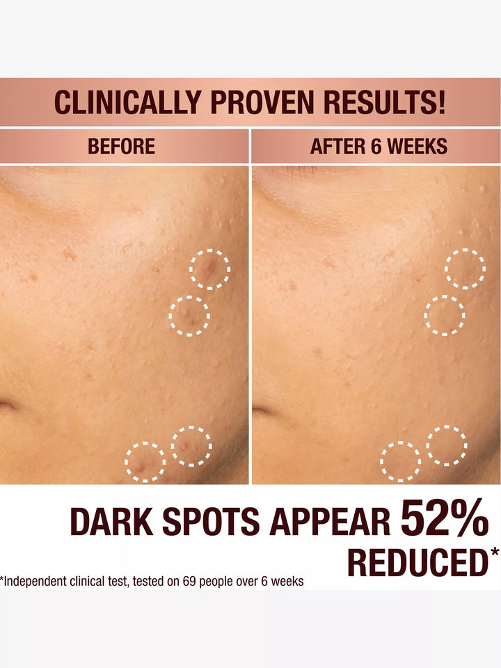 Dark Spot Correcting Radiance Recovery Serum - GLAM MODA