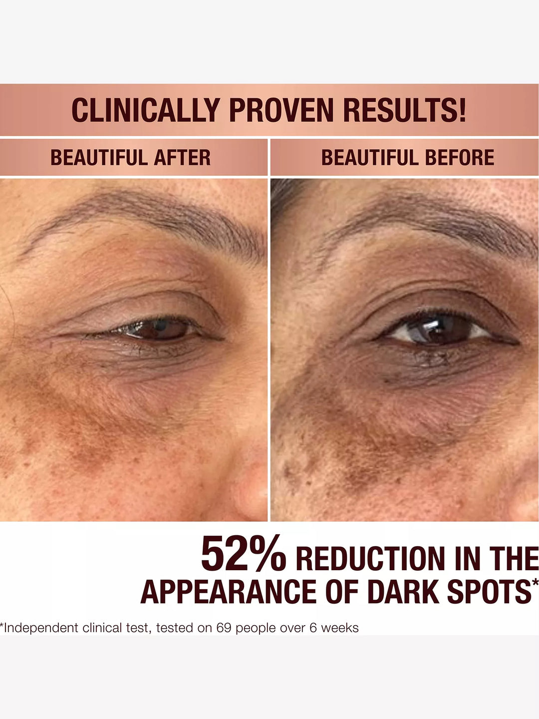 Dark Spot Correcting Radiance Recovery Serum - GLAM MODA