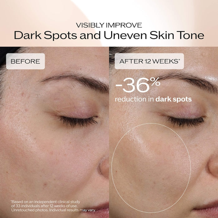 Benefiance Dark Spot and Wrinkle Smoothing Serum - GLAM MODA