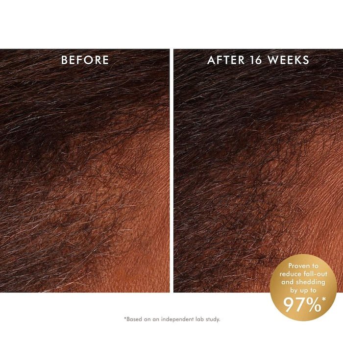 Revitalizing Scalp Tonic Treatment for Thinning Hair - GLAM MODA