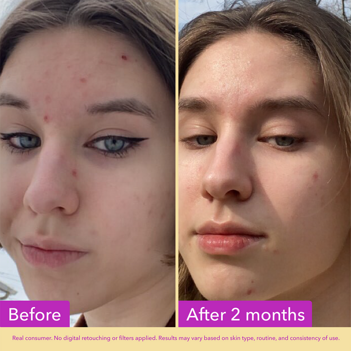 Niacinamide Serum - GLAM MODA