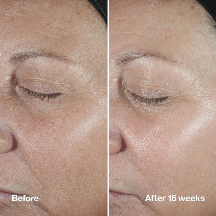 Clinique Smart Clinical Repair Wrinkle Correcting Serum - GLAM MODA