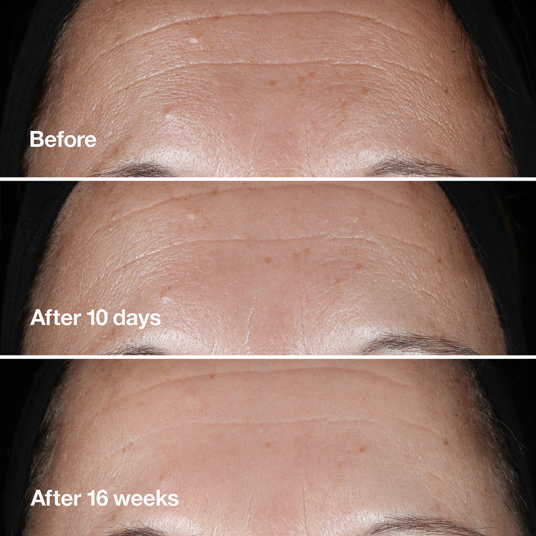 Clinique Smart Clinical Repair Wrinkle Correcting Serum - GLAM MODA