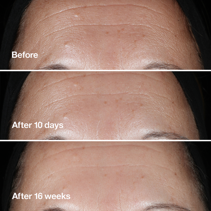 Clinique Smart Clinical Repair Wrinkle Correcting Serum - GLAM MODA