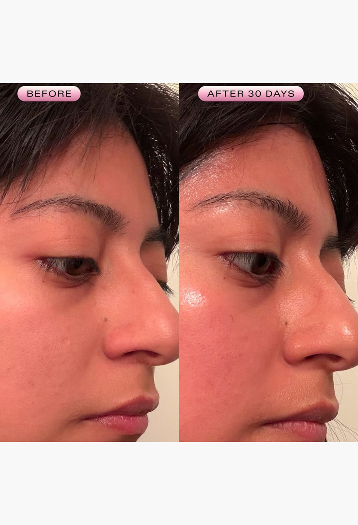 GLAM MODA before and after comparison showing improved skin hydration and radiance after using Mochi Berrier Cream