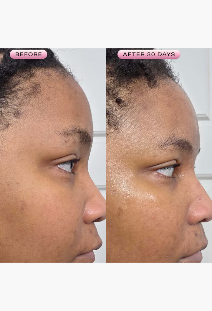 GLAM MODA side-by-side comparison of skin before and after 30 days of using KraveBeauty Mochi Berrier Moisture Cream