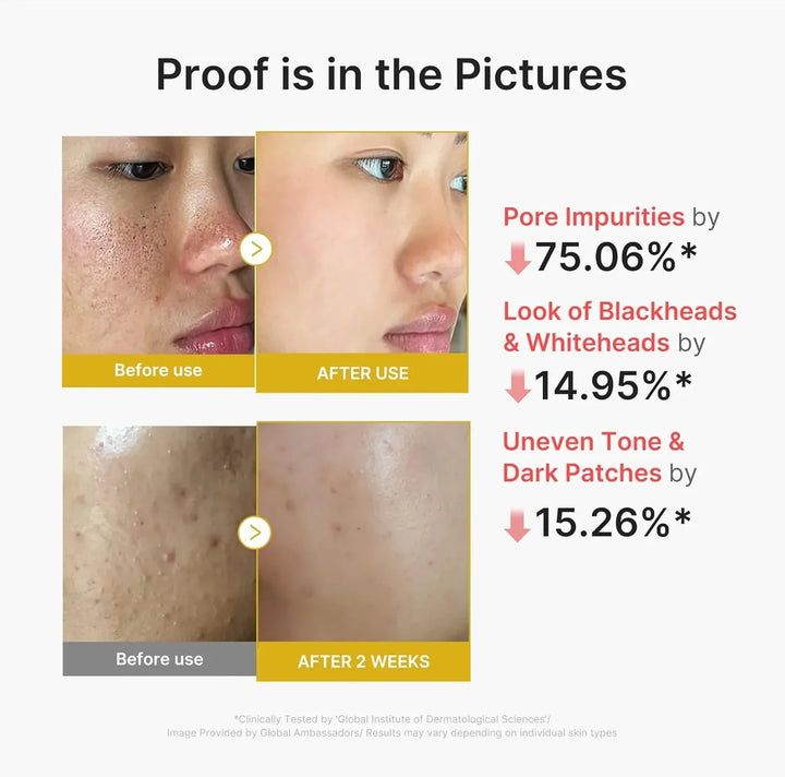 Kojic Acid Turmeric Peel Shot - GLAM MODA