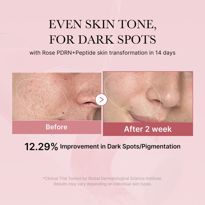 PDRN Pink Peptide Toner - Pink Glow Toner - GLAM MODA