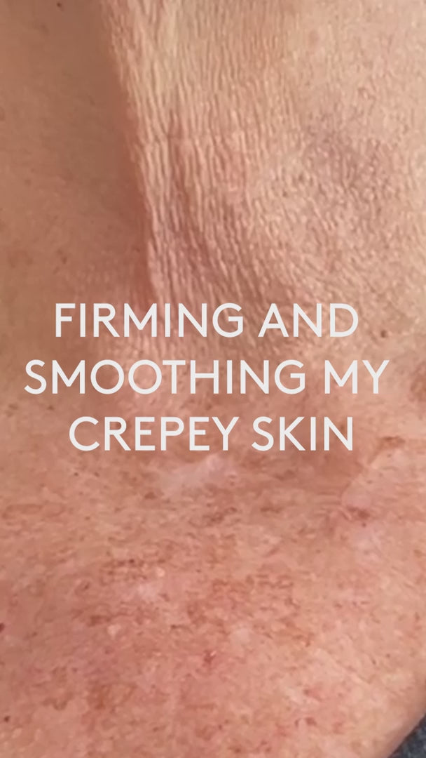 2% Granactive Retinoid 身體煥膚精華