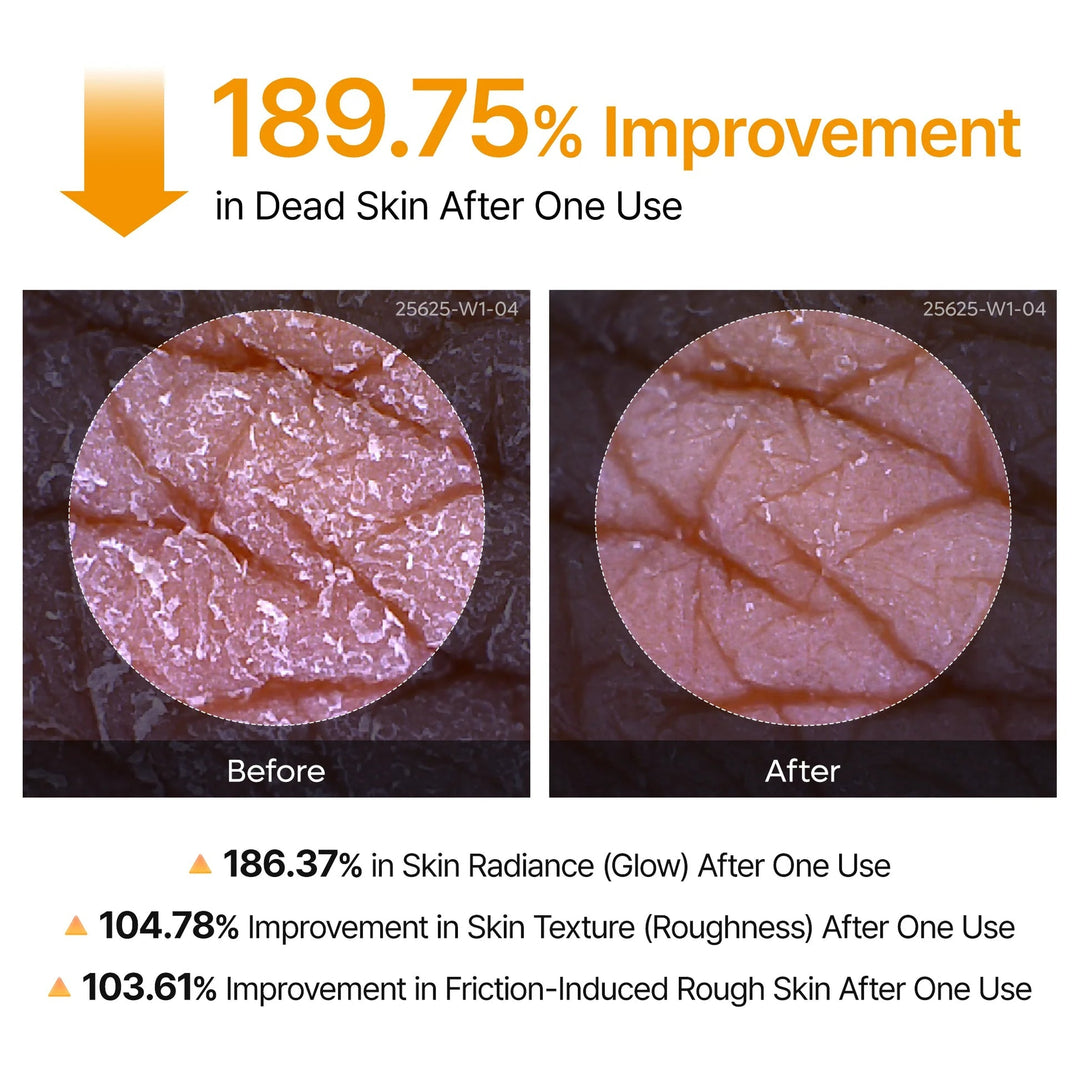 Peel Shot Exfoliating Kojic Acid Turmeric Spray - GLAM MODA