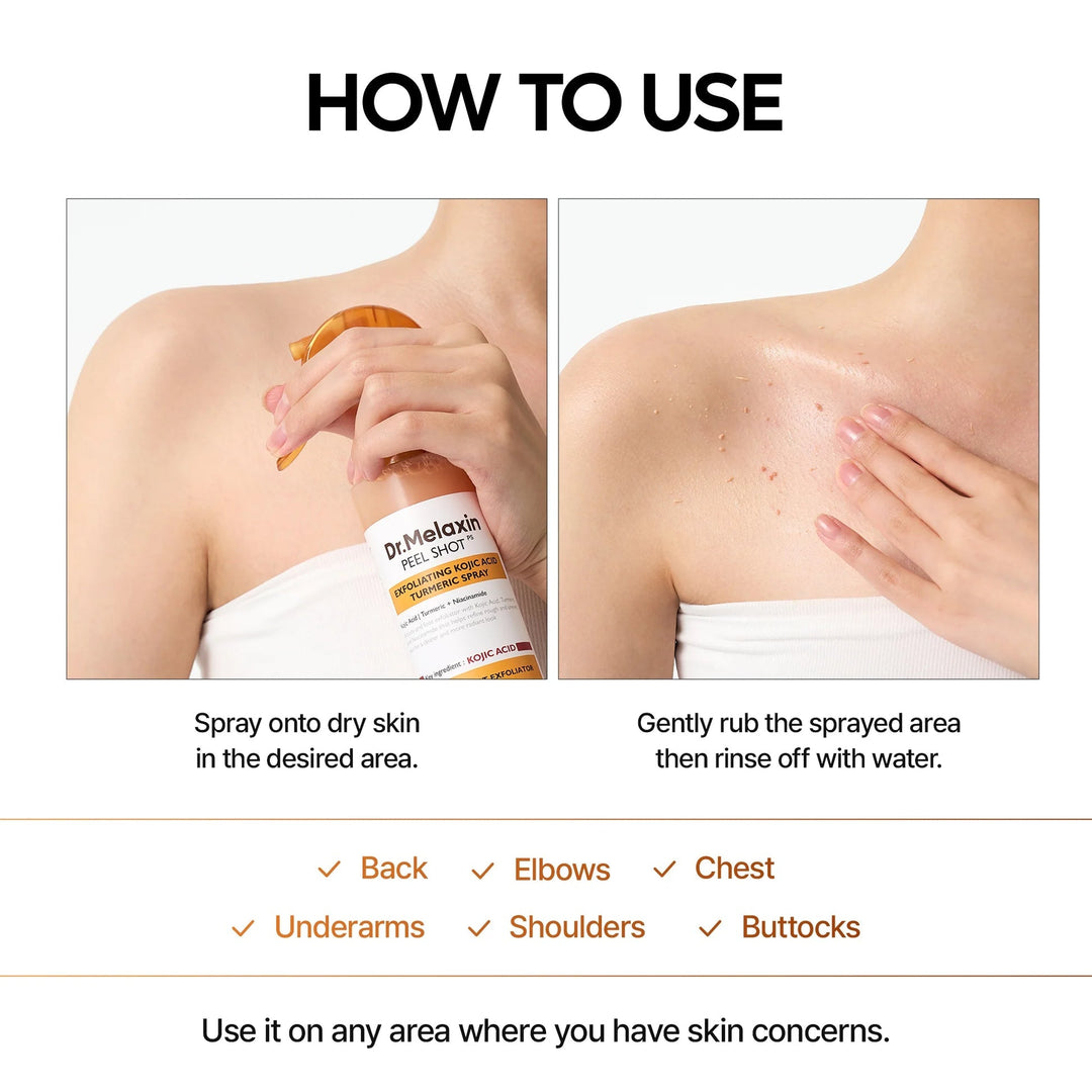 Peel Shot Exfoliating Kojic Acid Turmeric Spray - GLAM MODA