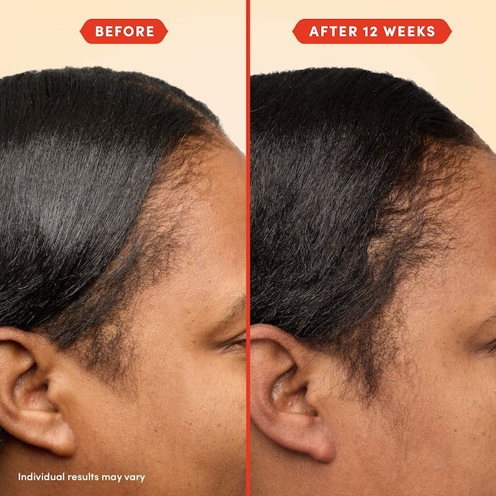 HoliRoots™ Pre-Wash Scalp & Hair Treatment Oil - GLAM MODA