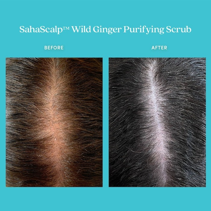 SahaScalp Wild Ginger Purifying Scrub - GLAM MODA
