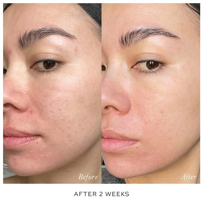 Skin Activator Serum with Hyaluronic Acid + Niacinamide - GLAM MODA