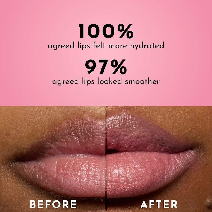 Forget the Filler Lip-Plumping Line-Smoothing Tinted Lip Balm - GLAM MODA