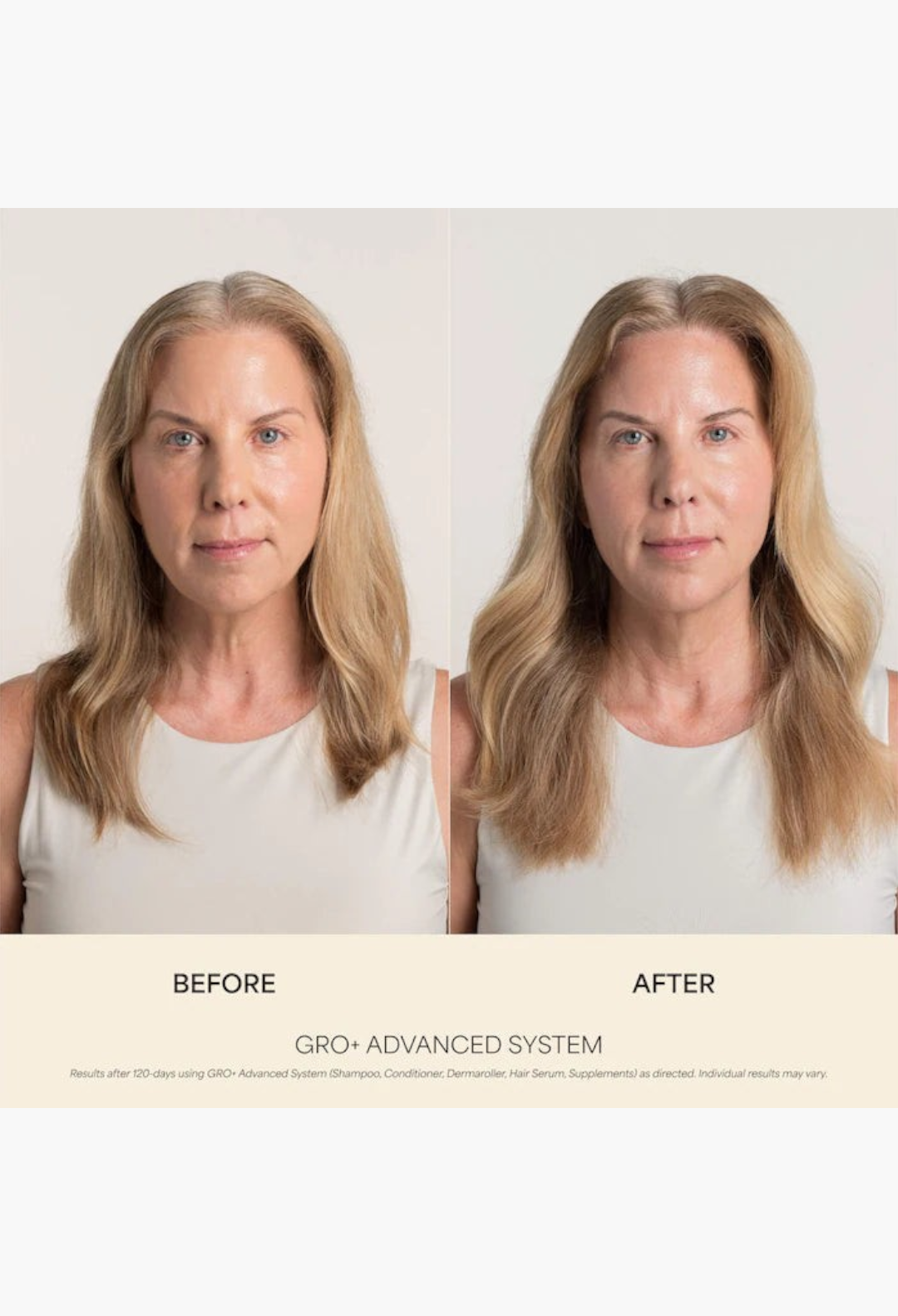 GLAM MODA before and after results of a woman using GRO+ Advanced hair care system for thinning hair volume
