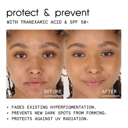 Conceal & Protect Spf 50+ Spot Concealer For Dark Spots - GLAM MODA