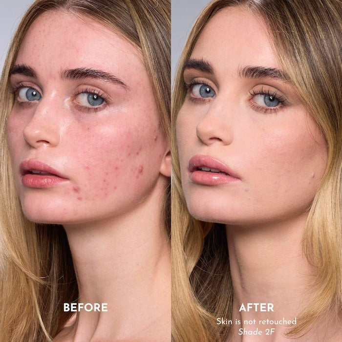 Forget The Filler Skin-Plumping Line-Smoothing Foundation - GLAM MODA