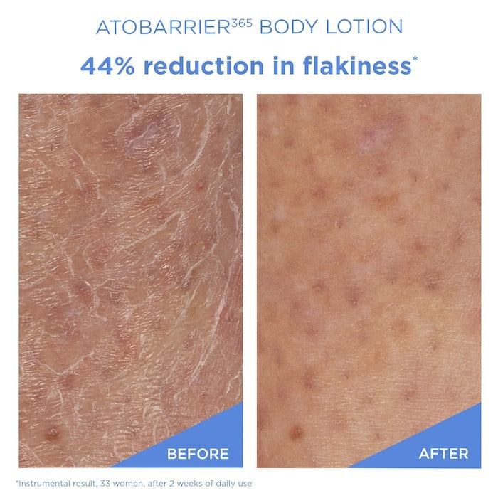 Atobarrier365 Moisturizing Body Lotion With Ceramides For Dry & Sensitive Skin - GLAM MODA