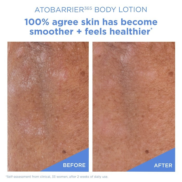Atobarrier365 Moisturizing Body Lotion With Ceramides For Dry & Sensitive Skin - GLAM MODA