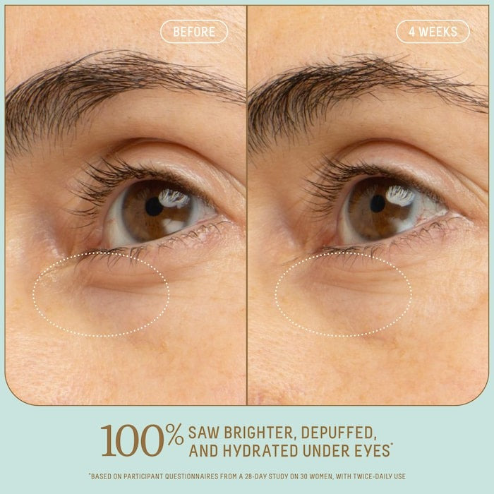 5% Niacinamide Brightening Eye Serum with Vitamin C + Squalane - GLAM MODA