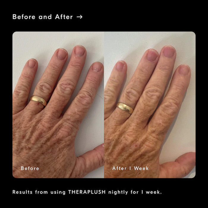 Soft Services x DedCool — Theraplush “Xtra Milk” Retinol Hand Repair Cream Refill