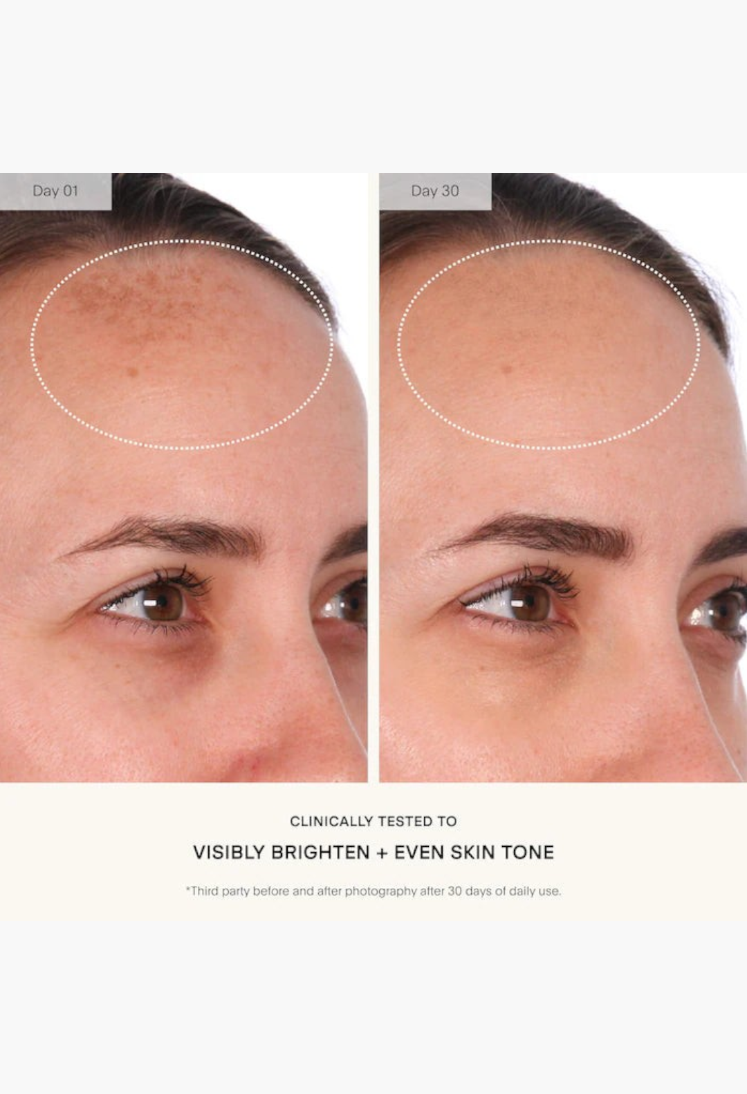 GLAM MODA clinical before and after results showing reduced dark spots and brighter skin tone after 30 days of use.
