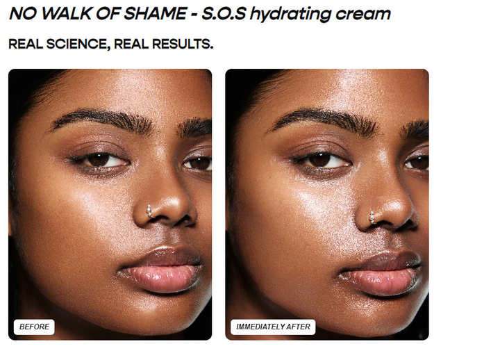 BREAKOUT-PRONE SKIN KIT - GLAM MODA